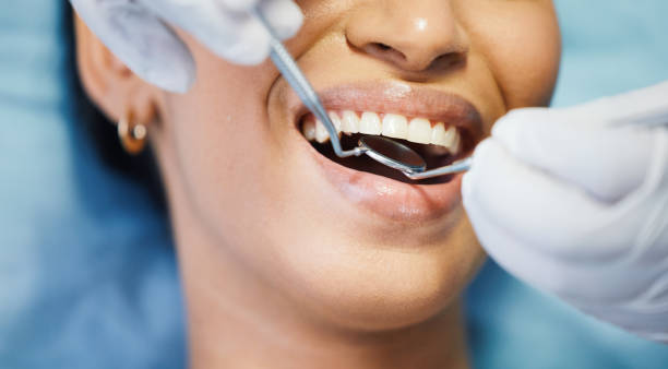 Best Emergency Broken Tooth Repair in Woodville, WI