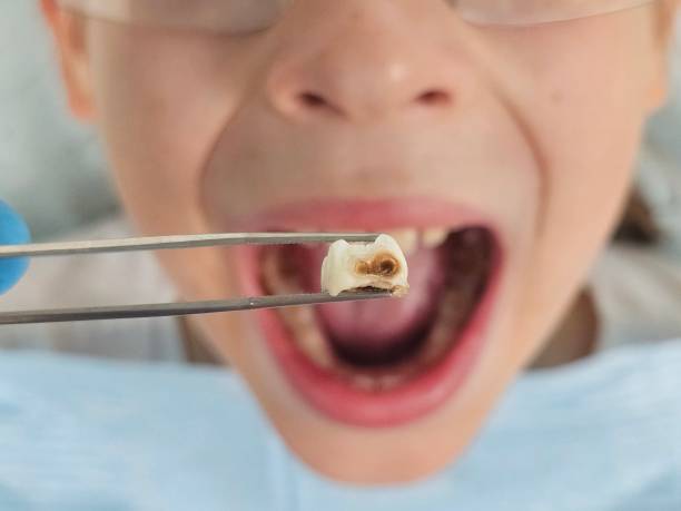 Best Emergency Treatment for Toothache in Woodville, WI